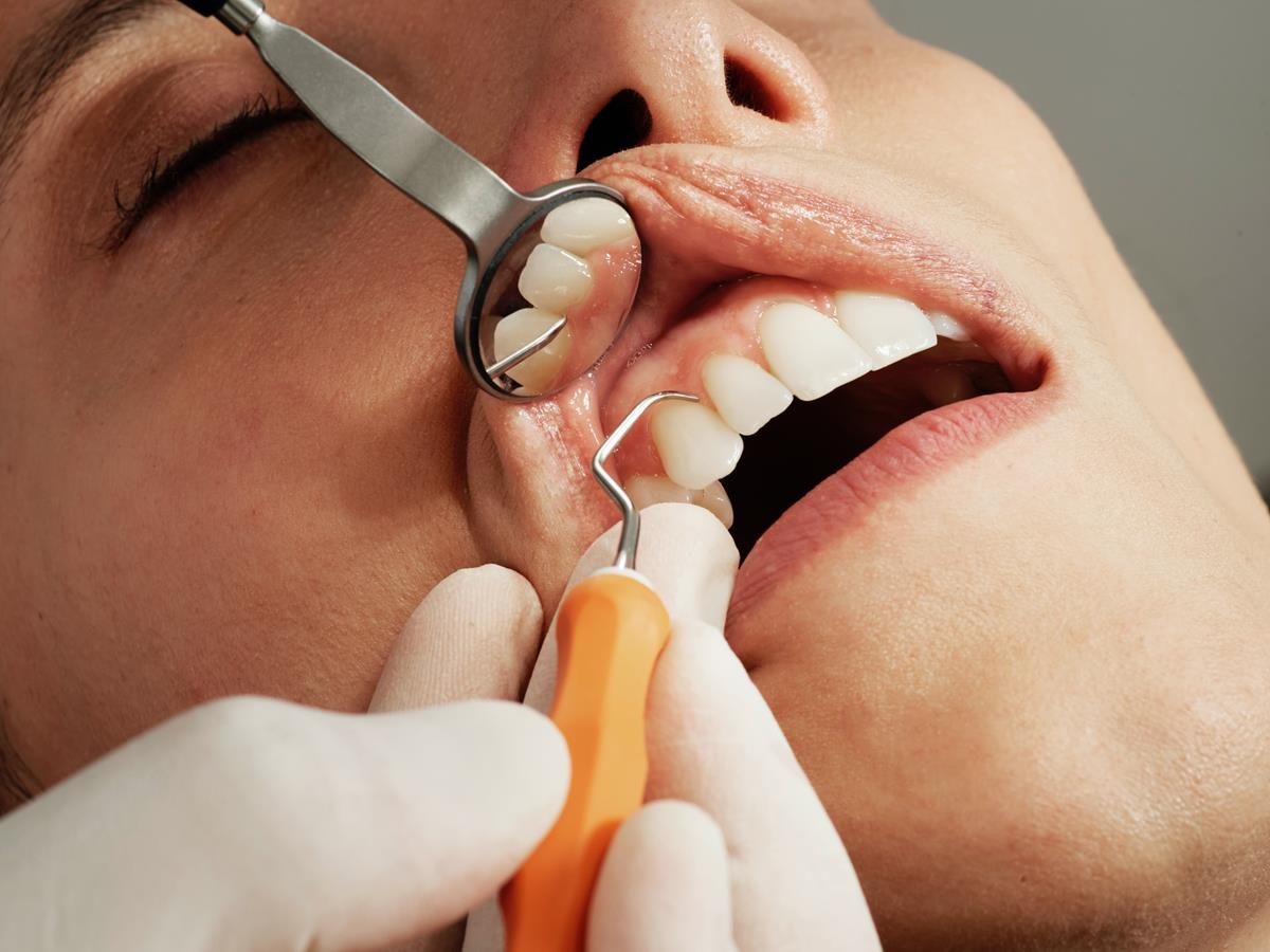 Jak podchodzi się do stworzenia aparatu ortodontycznego?